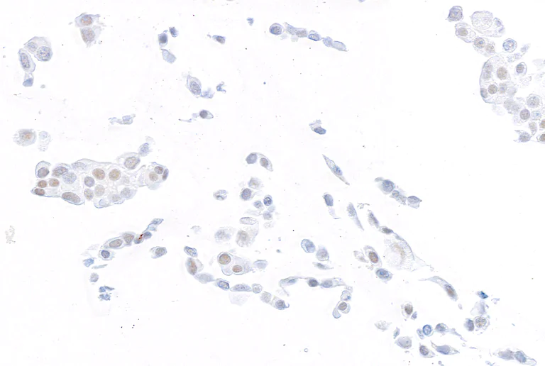 Immunocytochemistry - Anti-ThPOK antibody [BLR191J] - BSA free (AB314067)