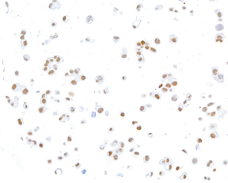 Immunocytochemistry - Anti-ThPOK antibody [BLR191J] - BSA free (AB314067)