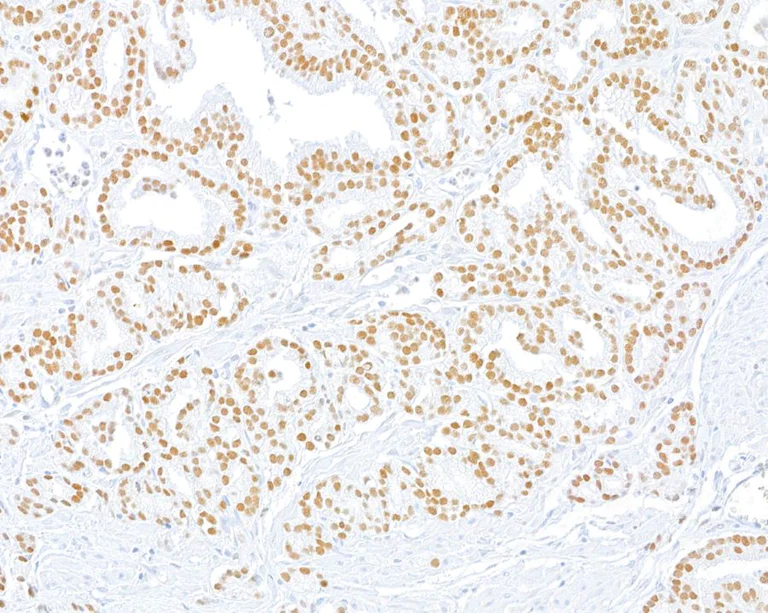 Immunohistochemistry (Formalin/PFA-fixed paraffin-embedded sections) - Anti-ThPOK antibody [BLR191J] - BSA free (AB314067)
