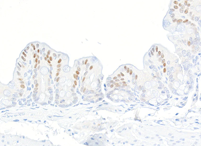 Immunohistochemistry (Formalin/PFA-fixed paraffin-embedded sections) - Anti-ThPOK antibody [BLR191J] - BSA free (AB314067)