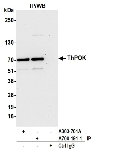 Immunoprecipitation - Anti-ThPOK antibody [BLR191J] - BSA free (AB314067)