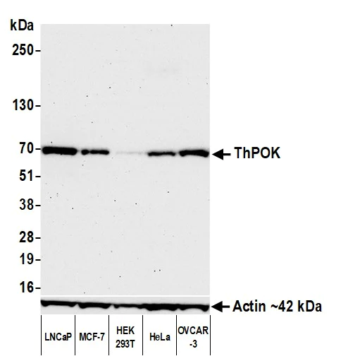 Western blot - Anti-ThPOK antibody [BLR191J] - BSA free (AB314067)