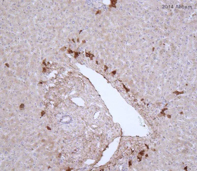 Immunohistochemistry (Formalin/PFA-fixed paraffin-embedded sections) - Anti-Thrombin antibody [5G9] (AB17199)