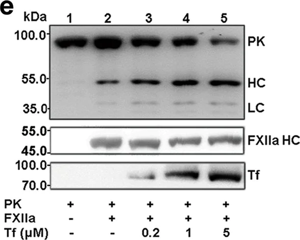 Western blot - Anti-Thrombin antibody [5G9] (AB17199)