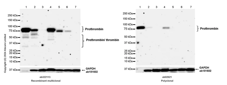 Western blot - Anti-Thrombin antibody (AB92621)