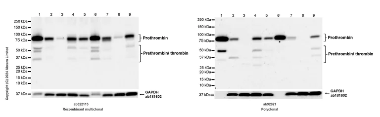 Western blot - Anti-Thrombin antibody (AB92621)
