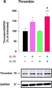 Western blot - Anti-Thrombin antibody (AB92621)