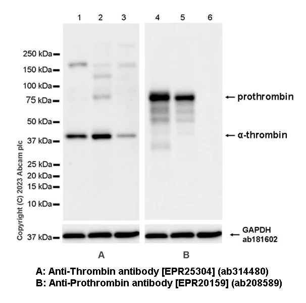 Western blot - Anti-Thrombin antibody [EPR25304-12] (AB314480)