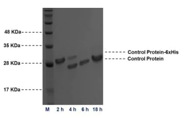 Purification - Thrombin cleavage kit (AB207000)