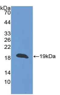 Western blot - Anti-Thrombomodulin antibody (AB233286)