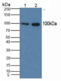 Western blot - Anti-Thrombomodulin antibody (AB233286)