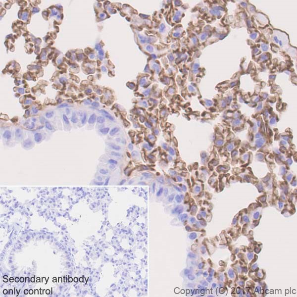 Immunohistochemistry (Formalin/PFA-fixed paraffin-embedded sections) - Anti-Thrombomodulin antibody [EPR18217-209] (ab230010), expandable thumbnail