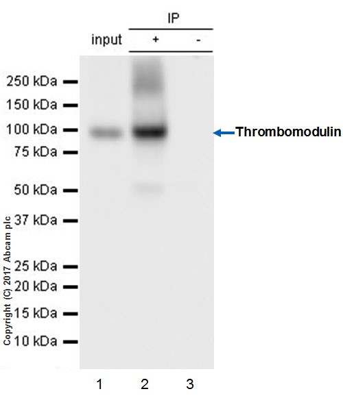 Immunoprecipitation - Anti-Thrombomodulin antibody [EPR18217-209] (AB230010), expandable thumbnail