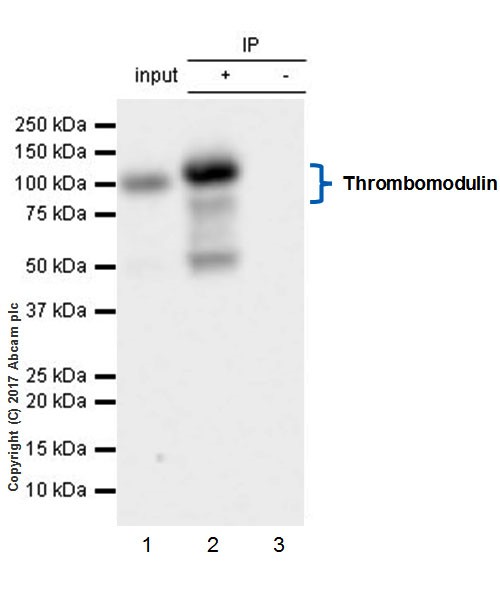 Immunoprecipitation - Anti-Thrombomodulin antibody [EPR18217-209] (AB230010), expandable thumbnail