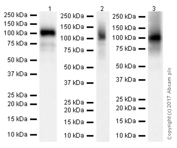 Western blot - Anti-Thrombomodulin antibody [EPR18217-209] (AB230010)