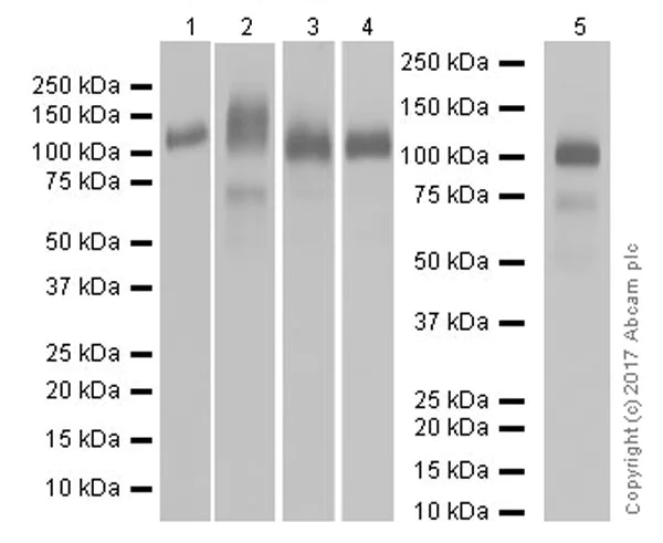 Western blot - Anti-Thrombomodulin antibody [EPR18217] (AB187075)