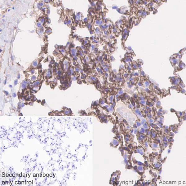 Immunohistochemistry (Formalin/PFA-fixed paraffin-embedded sections) - Anti-Thrombomodulin antibody [EPR18217] - BSA and Azide free (AB225552)