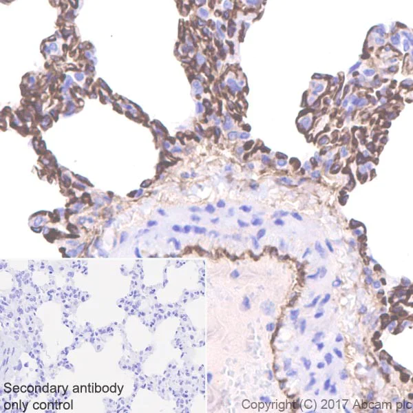 Immunohistochemistry (Formalin/PFA-fixed paraffin-embedded sections) - Anti-Thrombomodulin antibody [EPR18217] - BSA and Azide free (AB225552)