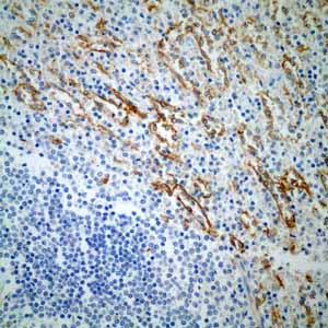 Immunohistochemistry (Formalin/PFA-fixed paraffin-embedded sections) - Anti-Thrombomodulin antibody [EPR4051] (AB109189)
