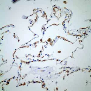 Immunohistochemistry (Formalin/PFA-fixed paraffin-embedded sections) - Anti-Thrombomodulin antibody [EPR4051] (AB109189)