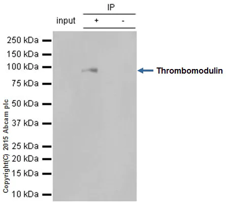 Immunoprecipitation - Anti-Thrombomodulin antibody [EPR4051] (AB109189)