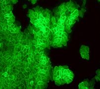 Immunocytochemistry/ Immunofluorescence - Anti-Thrombomodulin antibody [EPR4051] - BSA and Azide free (AB271880), expandable thumbnail