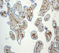 Immunohistochemistry (Formalin/PFA-fixed paraffin-embedded sections) - Anti-Thrombomodulin antibody [EPR4051] - BSA and Azide free (ab271880), expandable thumbnail