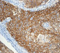 Immunohistochemistry (Formalin/PFA-fixed paraffin-embedded sections) - Anti-Thrombomodulin antibody [EPR4051] - BSA and Azide free (ab271880), expandable thumbnail
