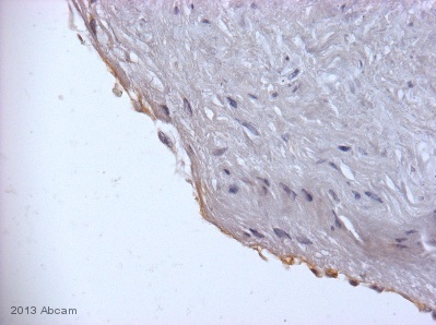 Immunohistochemistry (Formalin/PFA-fixed paraffin-embedded sections) - Anti-Thrombomodulin antibody [EPR4051] - BSA and Azide free (ab271880), expandable thumbnail