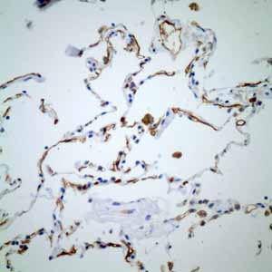 Immunohistochemistry (Formalin/PFA-fixed paraffin-embedded sections) - Anti-Thrombomodulin antibody [EPR4051] - BSA and Azide free (ab271880), expandable thumbnail