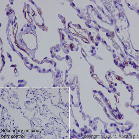 Immunohistochemistry (Formalin/PFA-fixed paraffin-embedded sections) - Anti-Thrombomodulin antibody [EPR4051] - BSA and Azide free (AB271880), expandable thumbnail