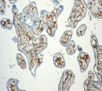 Immunohistochemistry (Formalin/PFA-fixed paraffin-embedded sections) - Anti-Thrombomodulin antibody [EPR4051] - Low endotoxin, Azide free (AB222292)