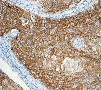 Immunohistochemistry (Formalin/PFA-fixed paraffin-embedded sections) - Anti-Thrombomodulin antibody [EPR4051] - Low endotoxin, Azide free (AB222292)