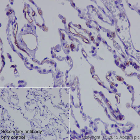 Immunohistochemistry (Formalin/PFA-fixed paraffin-embedded sections) - Anti-Thrombomodulin antibody [EPR4051] - Low endotoxin, Azide free (AB222292)