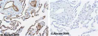 Immunohistochemistry (Formalin/PFA-fixed paraffin-embedded sections) - Anti-Thrombomodulin antibody [PBS-01] (AB6980)