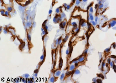 Immunohistochemistry (Formalin/PFA-fixed paraffin-embedded sections) - Anti-Thrombomodulin antibody [PBS-02] (AB7640)