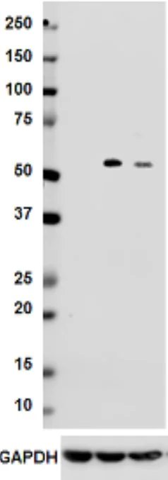 Western blot - Anti-Thrombomodulin antibody [Phx-01] (AB24595)
