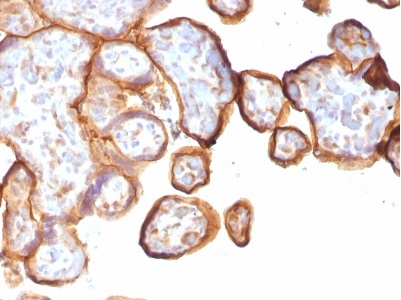 Immunohistochemistry (Formalin/PFA-fixed paraffin-embedded sections) - Anti-Thrombomodulin antibody [rTHBD/1591] - BSA and Azide free (AB237912), expandable thumbnail