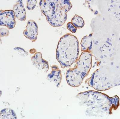 Immunohistochemistry (Formalin/PFA-fixed paraffin-embedded sections) - Anti-Thrombomodulin antibody [SP309] - BSA and Azide free (AB272018)