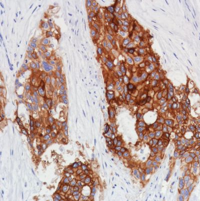 Immunohistochemistry (Formalin/PFA-fixed paraffin-embedded sections) - Anti-Thrombomodulin antibody [SP309] - BSA and Azide free (AB272018)