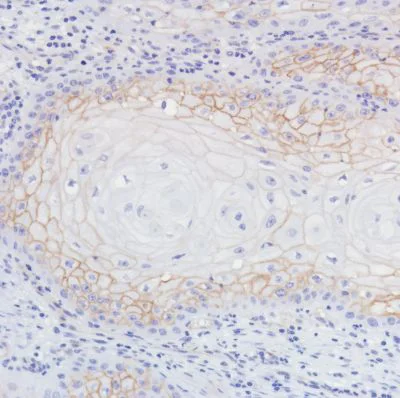 Immunohistochemistry (Formalin/PFA-fixed paraffin-embedded sections) - Anti-Thrombomodulin antibody [SP309] - BSA and Azide free (AB272018)