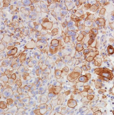 Immunohistochemistry (Formalin/PFA-fixed paraffin-embedded sections) - Anti-Thrombomodulin antibody [SP309] - BSA and Azide free (AB272018)