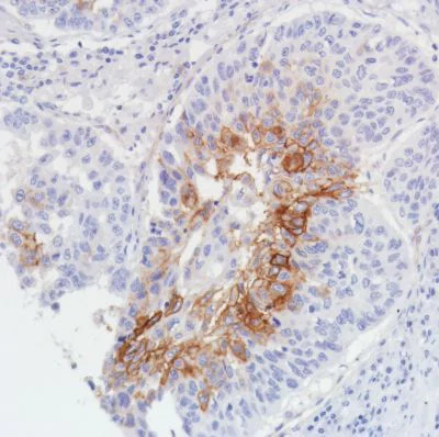 Immunohistochemistry (Formalin/PFA-fixed paraffin-embedded sections) - Anti-Thrombomodulin antibody [SP309] - BSA and Azide free (AB272018)