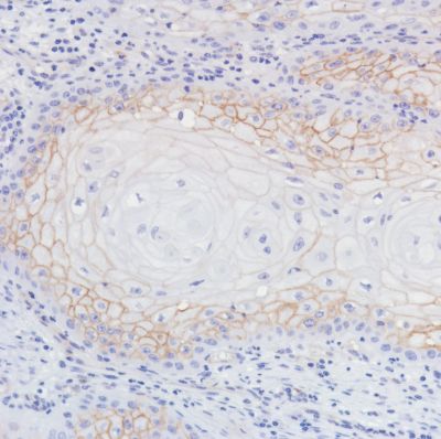 Immunohistochemistry (Formalin/PFA-fixed paraffin-embedded sections) - Anti-Thrombomodulin antibody [SP309] - C-terminal (AB227701), expandable thumbnail