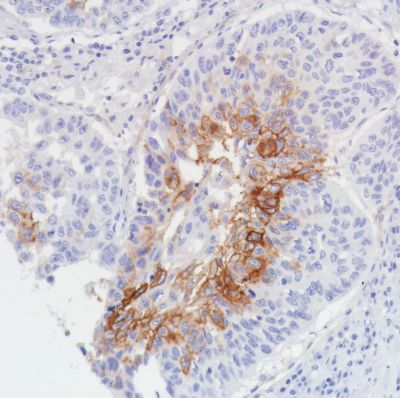 Immunohistochemistry (Formalin/PFA-fixed paraffin-embedded sections) - Anti-Thrombomodulin antibody [SP309] - C-terminal (AB227701), expandable thumbnail