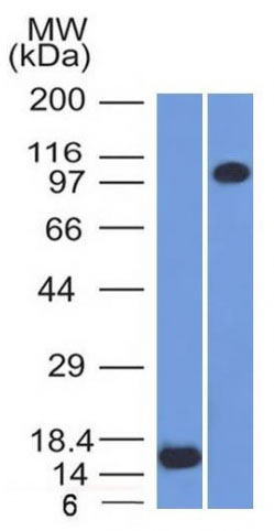 Western blot - Anti-Thrombomodulin antibody [THBD/1591] (AB218327), expandable thumbnail