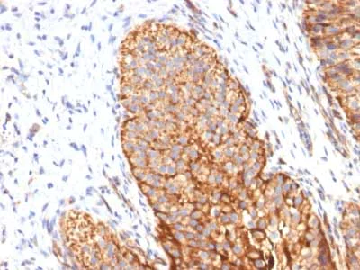 Immunohistochemistry (Formalin/PFA-fixed paraffin-embedded sections) - Anti-Thrombomodulin antibody [THBD/1591] - BSA and Azide free (AB269746)