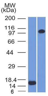 Western blot - Anti-Thrombomodulin antibody [THBD/1591] - BSA and Azide free (AB269746)