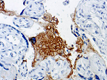 Immunohistochemistry (Formalin/PFA-fixed paraffin-embedded sections) - Anti-Thrombospondin 1 antibody [A6.1] (AB1823)
