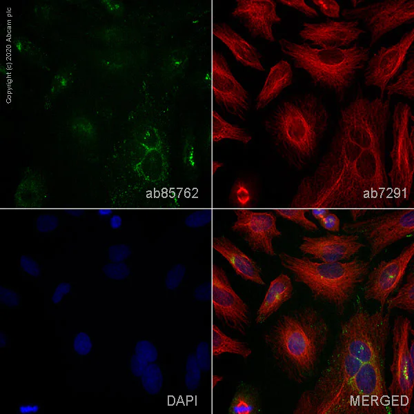 Immunocytochemistry/ Immunofluorescence - Anti-Thrombospondin 1 antibody (AB85762)